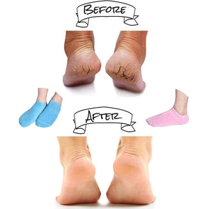 Moisturizing Socks with Gel Lining