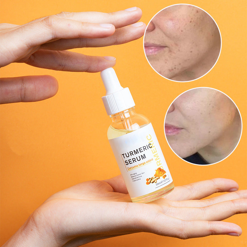 Turmeric Dark Spot Corrector Serum