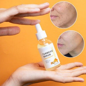 Turmeric Dark Spot Corrector Serum